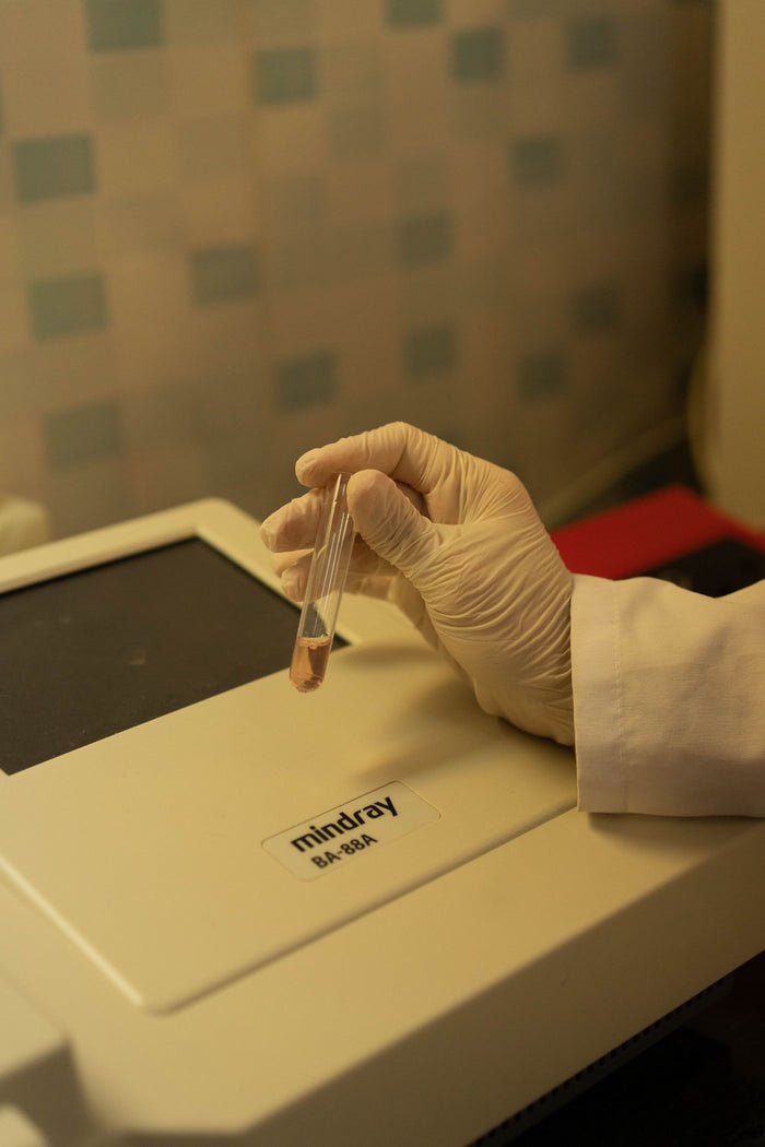 Técnico de laboratorio con guante sujetando un vial de muestra junto a un analizador fotométrico en un laboratorio clínico real
